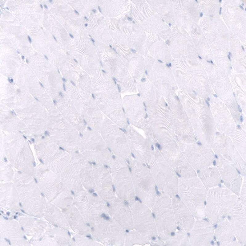 Mesothelin Antibody (CL13956) - Azide and BSA Free Immunohistochemistry-Paraffin: Mesothelin Antibody [NBP3-43845]