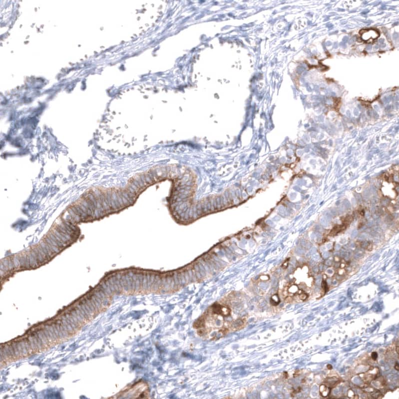 Mesothelin Antibody (CL13957) - Azide and BSA Free Immunohistochemistry-Paraffin: Mesothelin Antibody [NBP3-43846]