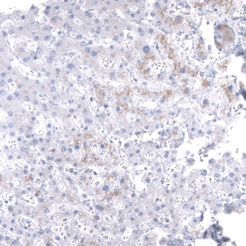 Mesothelin Antibody (CL13957) - Azide and BSA Free Immunohistochemistry-Paraffin: Mesothelin Antibody [NBP3-43846]