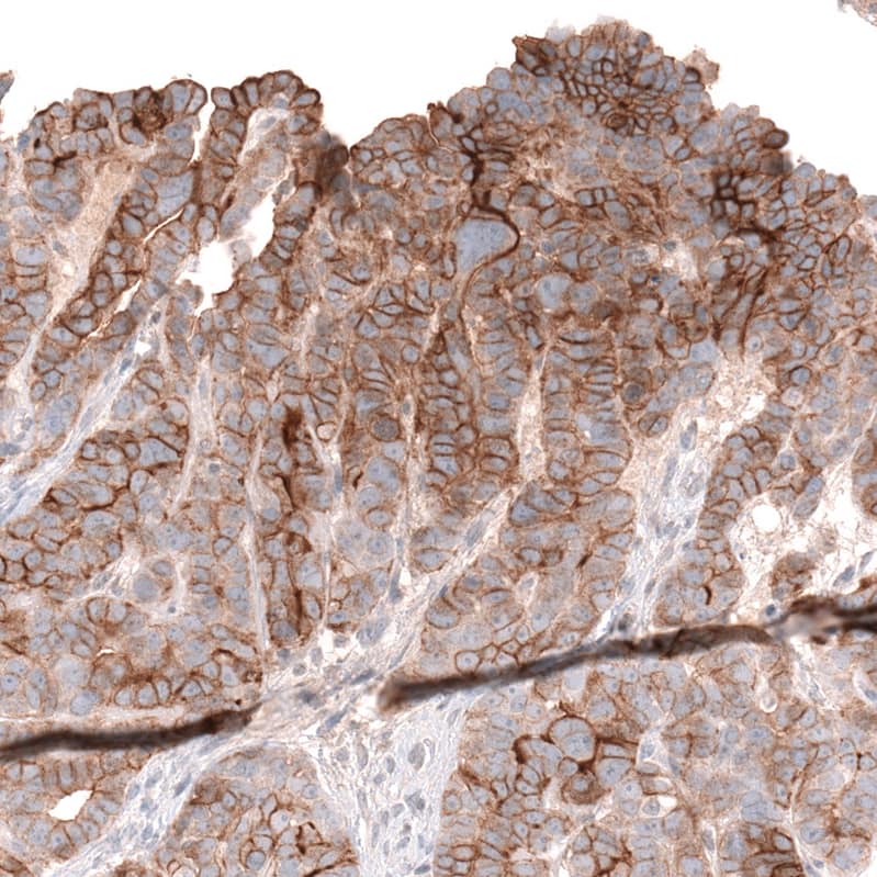 Mesothelin Antibody (CL13957) - Azide and BSA Free Immunohistochemistry-Paraffin: Mesothelin Antibody [NBP3-43846]