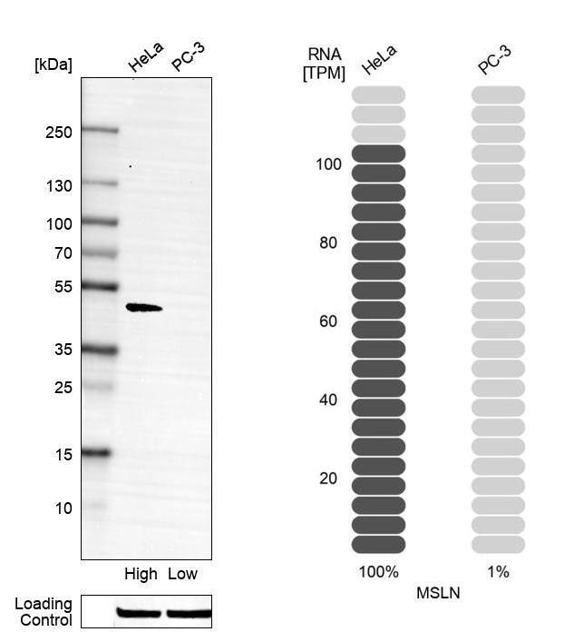 Mesothelin Antibody (CL13957) - Azide and BSA Free Western Blot: Mesothelin Antibody [NBP3-43846]