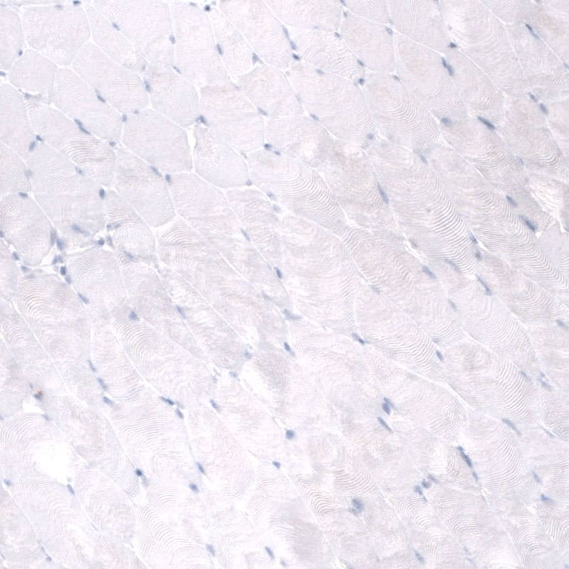 Mesothelin Antibody (CL13957) - Azide and BSA Free Immunohistochemistry-Paraffin: Mesothelin Antibody [NBP3-43846]