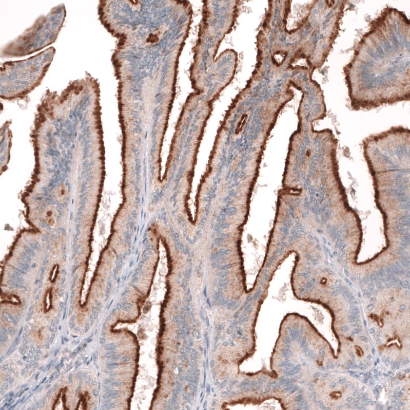 Mesothelin Antibody (CL13957) - Azide and BSA Free Immunohistochemistry-Paraffin: Mesothelin Antibody [NBP3-43846]