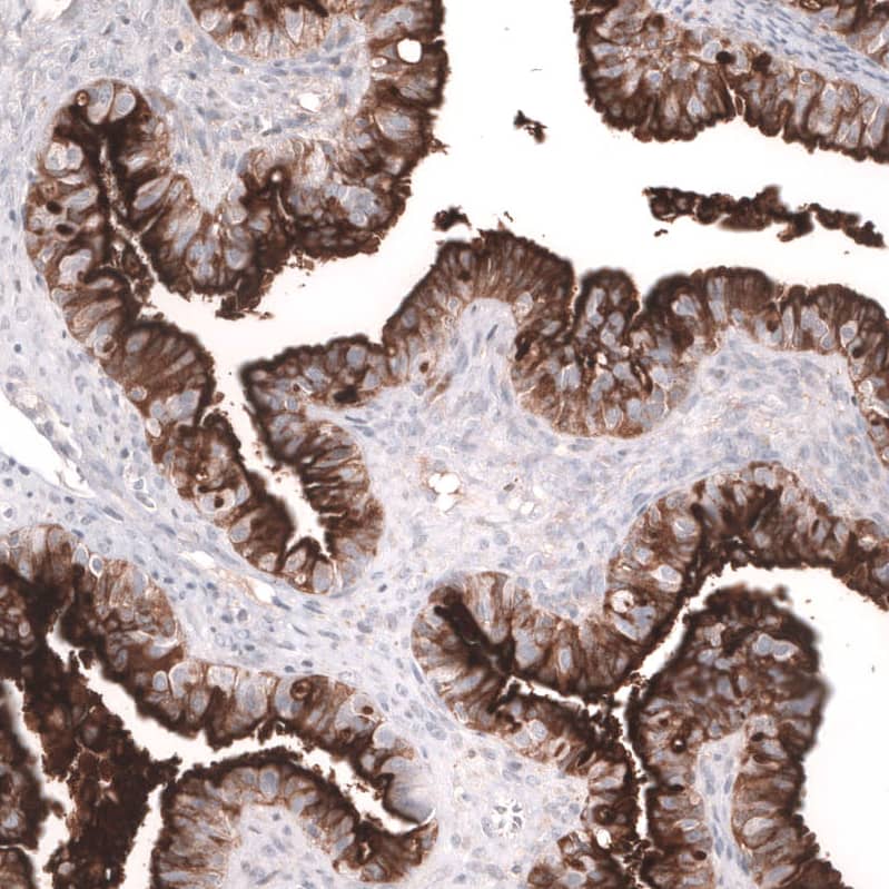 Mesothelin Antibody (CL13965) - Azide and BSA Free Immunohistochemistry-Paraffin: Mesothelin Antibody [NBP3-43848]