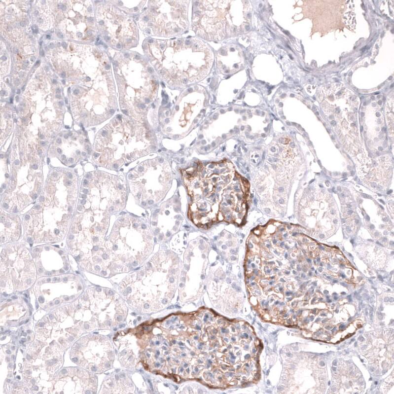 Mesothelin Antibody (CL13965) - Azide and BSA Free Immunohistochemistry-Paraffin: Mesothelin Antibody [NBP3-43848]