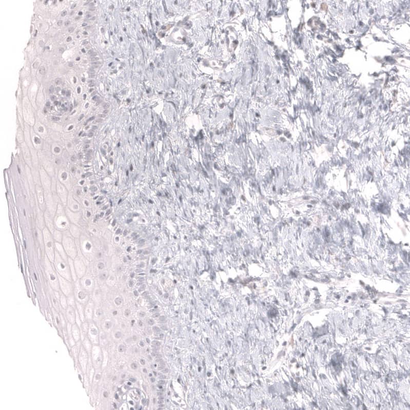 Mesothelin Antibody (CL13965) - Azide and BSA Free Immunohistochemistry-Paraffin: Mesothelin Antibody [NBP3-43848]