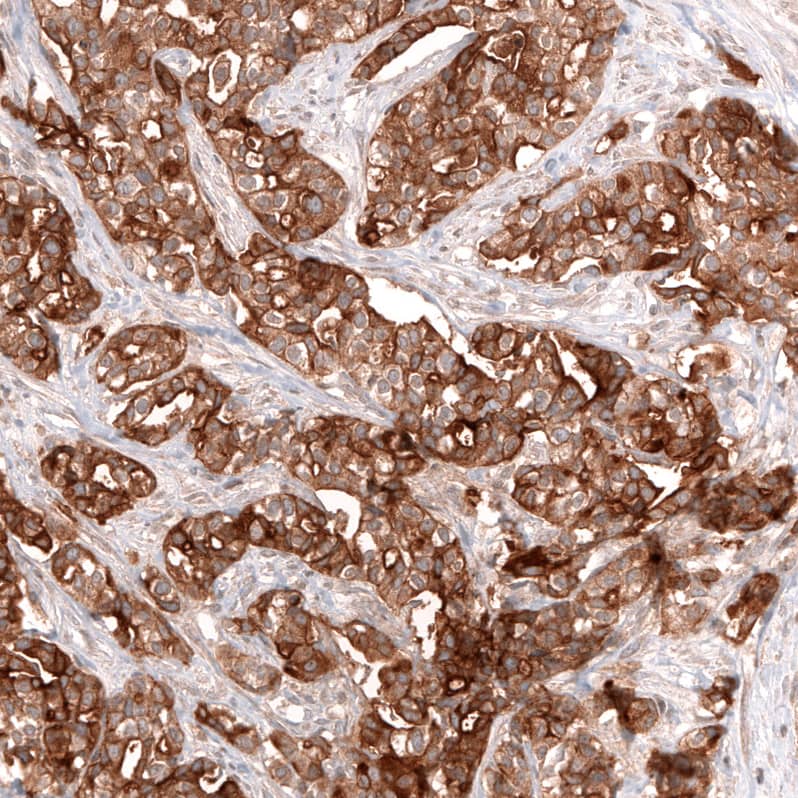 Mesothelin Antibody (CL13965) - Azide and BSA Free Immunohistochemistry-Paraffin: Mesothelin Antibody [NBP3-43848]