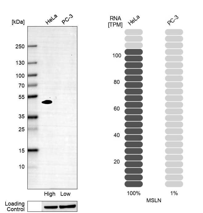 Mesothelin Antibody (CL13965) - Azide and BSA Free Western Blot: Mesothelin Antibody [NBP3-43848]