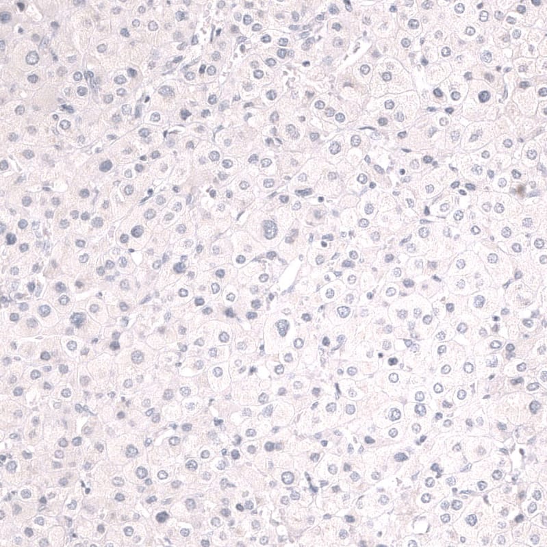 Mesothelin Antibody (CL13965) - Azide and BSA Free Immunohistochemistry-Paraffin: Mesothelin Antibody [NBP3-43848]