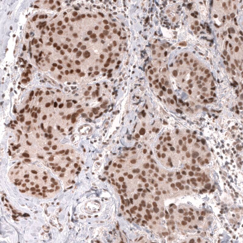 MLH3 Antibody (CL14084) - Azide and BSA Free Immunohistochemistry-Paraffin: MLH3 Antibody [NBP3-43849]