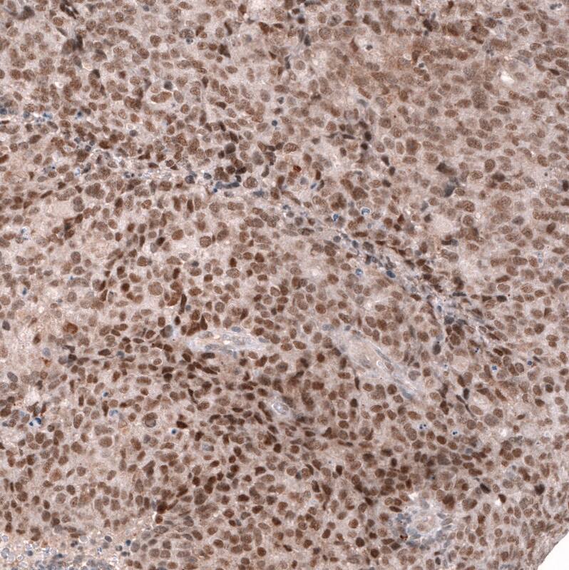 MLH3 Antibody (CL14084) - Azide and BSA Free Immunohistochemistry-Paraffin: MLH3 Antibody [NBP3-43849]
