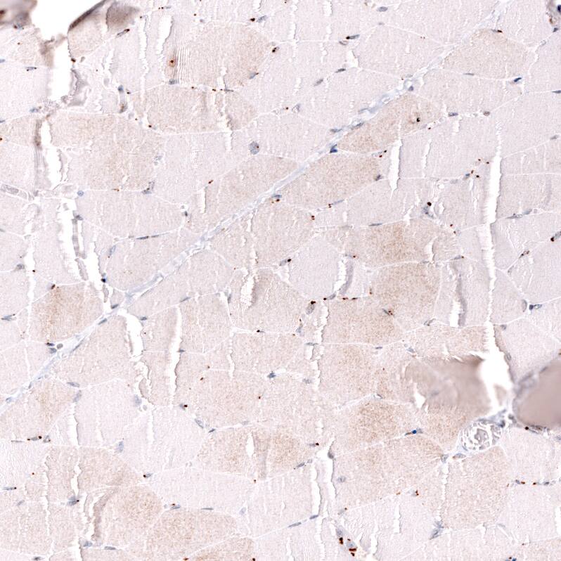 MLH3 Antibody (CL14084) - Azide and BSA Free Immunohistochemistry-Paraffin: MLH3 Antibody [NBP3-43849]