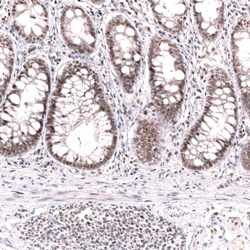 MLH3 Antibody (CL14084) - Azide and BSA Free Immunohistochemistry-Paraffin: MLH3 Antibody [NBP3-43849]