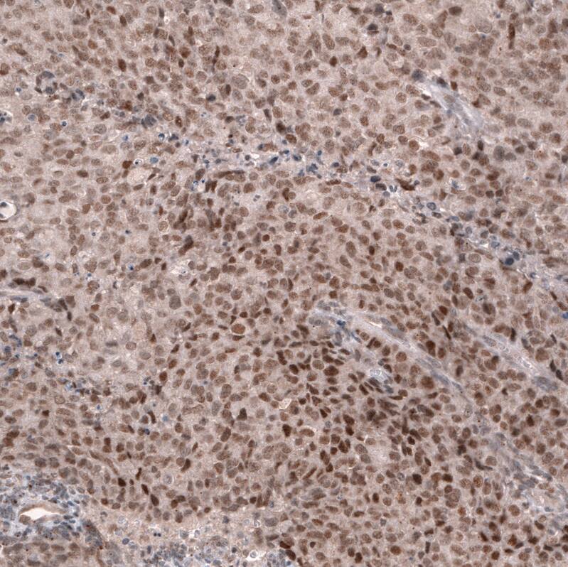 MLH3 Antibody (CL14096) - Azide and BSA Free Immunohistochemistry-Paraffin: MLH3 Antibody [NBP3-43850]
