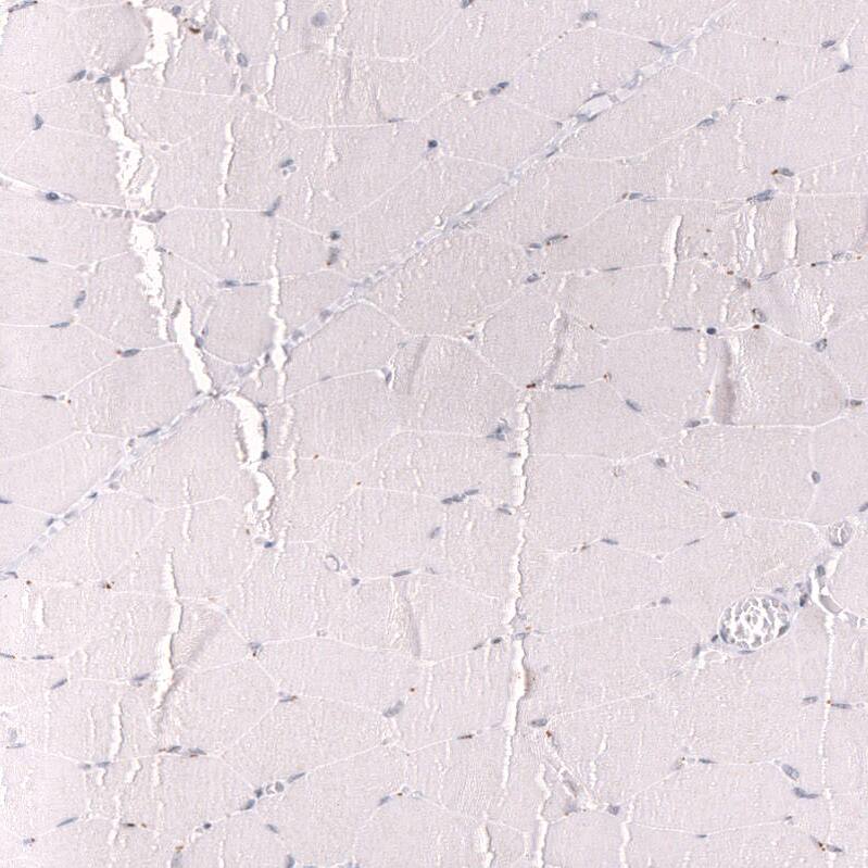 MLH3 Antibody (CL14096) - Azide and BSA Free Immunohistochemistry-Paraffin: MLH3 Antibody [NBP3-43850]