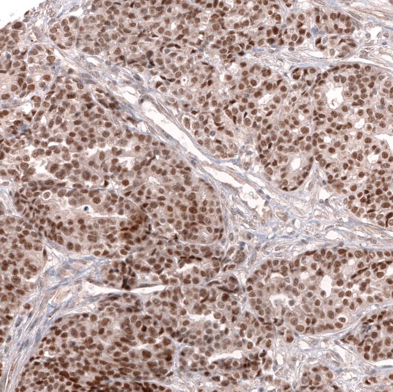 MLH3 Antibody (CL14096) - Azide and BSA Free Immunohistochemistry-Paraffin: MLH3 Antibody [NBP3-43850]