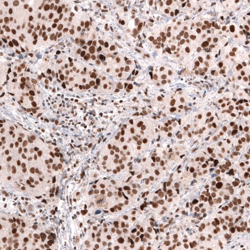 MSH2 Antibody (CL13713) - Azide and BSA Free Immunohistochemistry-Paraffin: MSH2 Antibody [NBP3-43851]
