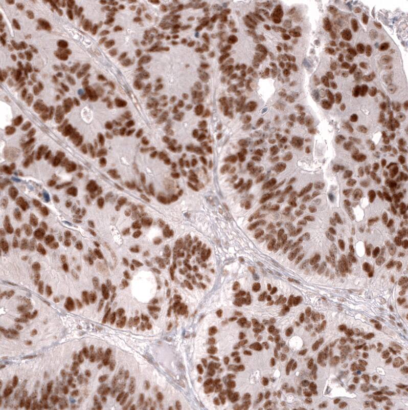 MSH2 Antibody (CL13713) - Azide and BSA Free Immunohistochemistry-Paraffin: MSH2 Antibody [NBP3-43851]
