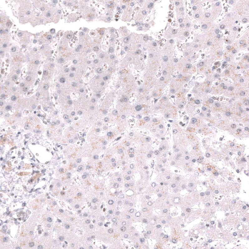 MSH2 Antibody (CL13713) - Azide and BSA Free Immunohistochemistry-Paraffin: MSH2 Antibody [NBP3-43851]
