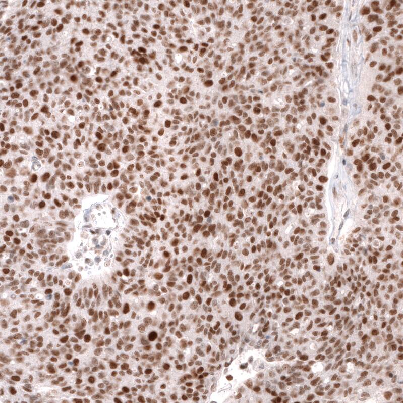 MSH2 Antibody (CL13713) - Azide and BSA Free Immunohistochemistry-Paraffin: MSH2 Antibody [NBP3-43851]