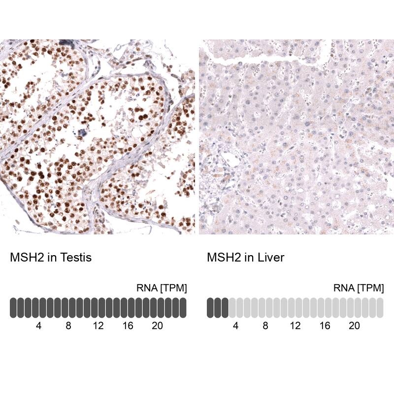 MSH2 Antibody (CL13713) - Azide and BSA Free Immunohistochemistry-Paraffin: MSH2 Antibody [NBP3-43851]