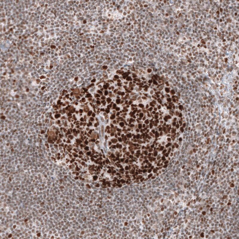 MSH2 Antibody (CL13713) - Azide and BSA Free Immunohistochemistry-Paraffin: MSH2 Antibody [NBP3-43851]