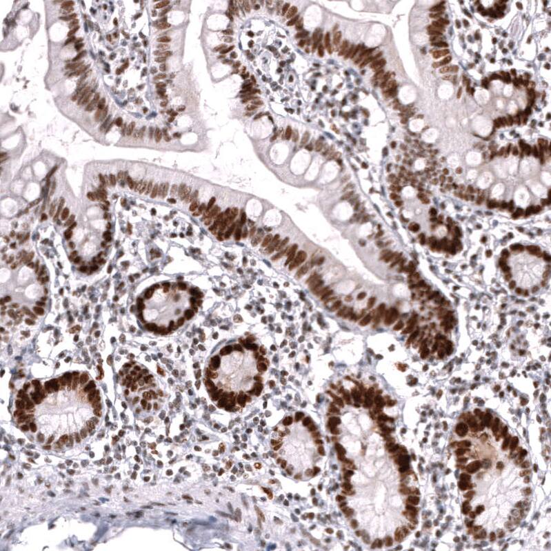 MSH2 Antibody (CL13713) - Azide and BSA Free Immunohistochemistry-Paraffin: MSH2 Antibody [NBP3-43851]