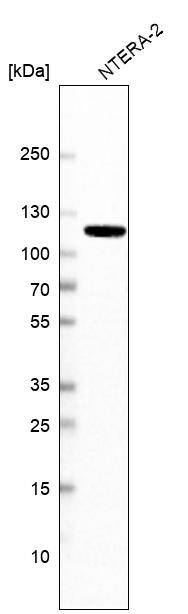 MSH2 Antibody (CL13713) - Azide and BSA Free Western Blot: MSH2 Antibody [NBP3-43851]