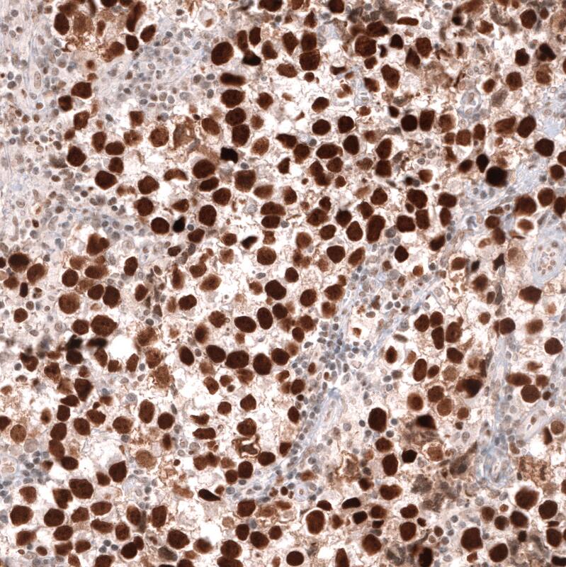 MSH2 Antibody (CL13713) - Azide and BSA Free Immunohistochemistry-Paraffin: MSH2 Antibody [NBP3-43851]