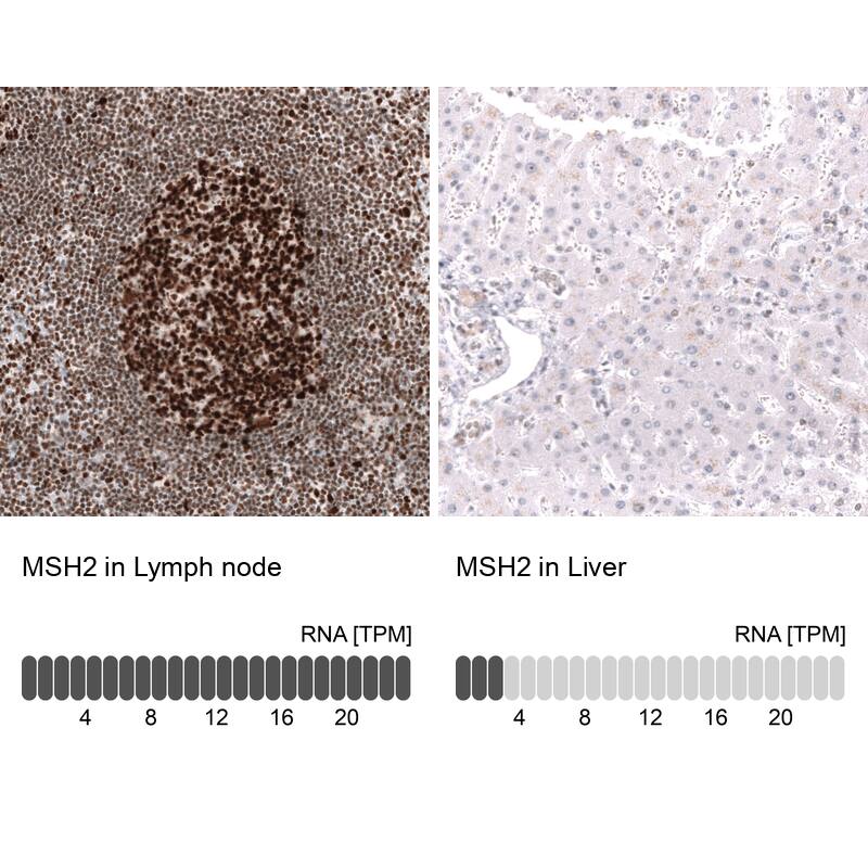 MSH2 Antibody (CL13724) - Azide and BSA Free Immunohistochemistry-Paraffin: MSH2 Antibody [NBP3-43852]