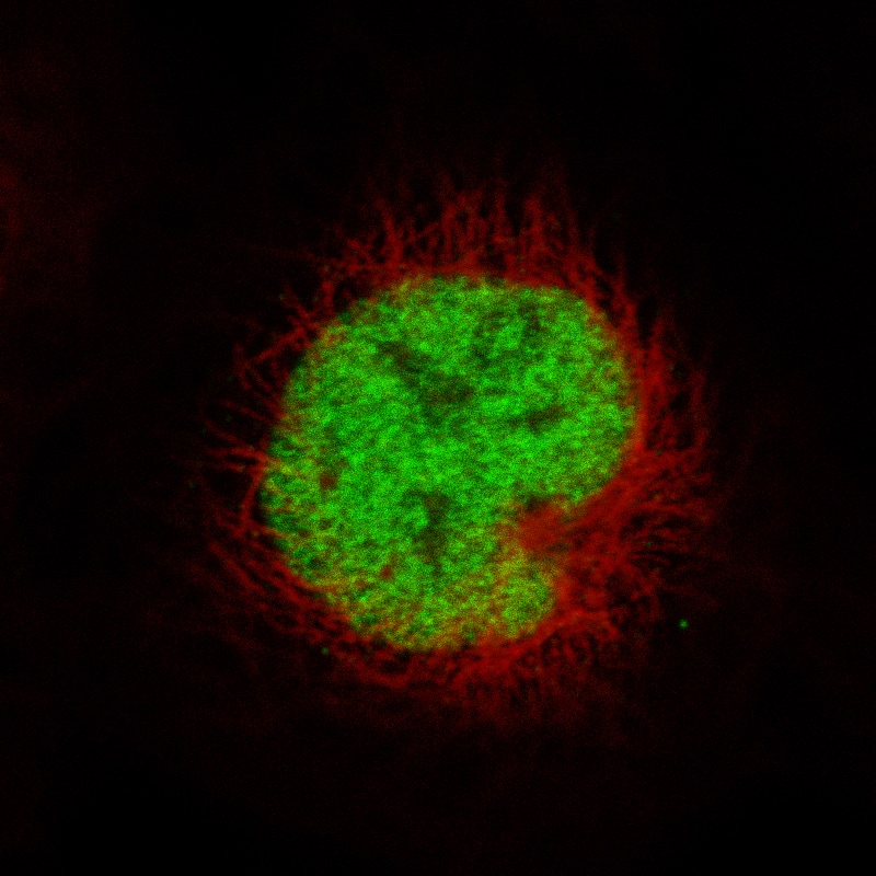 MSH2 Antibody (CL13724) - Azide and BSA Free Immunocytochemistry/ Immunofluorescence: MSH2 Antibody [NBP3-43852]