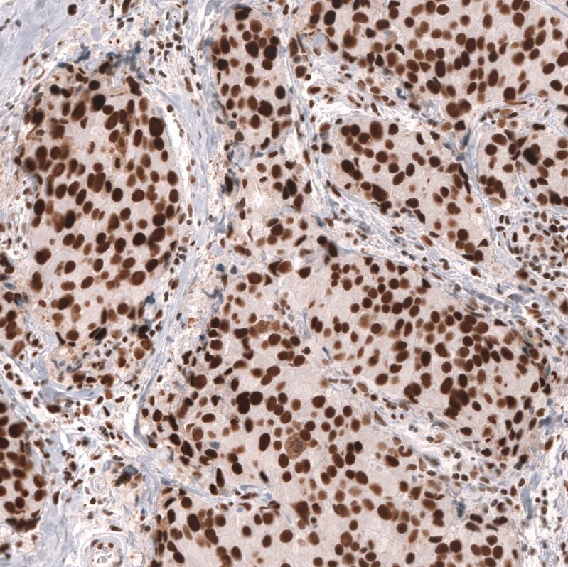 MSH2 Antibody (CL13724) - Azide and BSA Free Immunohistochemistry-Paraffin: MSH2 Antibody [NBP3-43852]