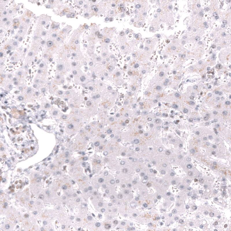MSH2 Antibody (CL13724) - Azide and BSA Free Immunohistochemistry-Paraffin: MSH2 Antibody [NBP3-43852]