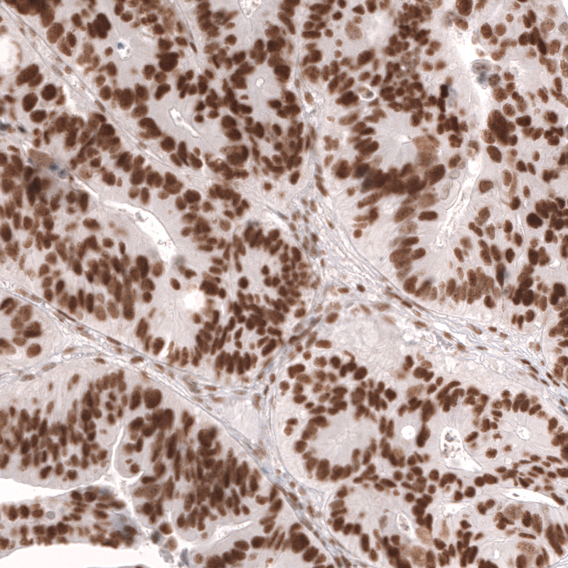 MSH2 Antibody (CL13724) - Azide and BSA Free Immunohistochemistry-Paraffin: MSH2 Antibody [NBP3-43852]