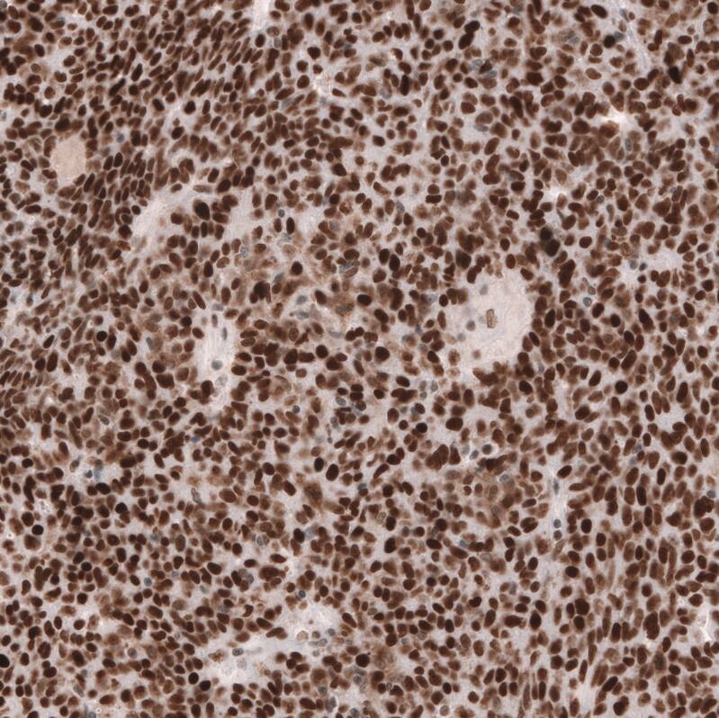MSH2 Antibody (CL13724) - Azide and BSA Free Immunohistochemistry-Paraffin: MSH2 Antibody [NBP3-43852]