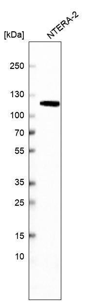 MSH2 Antibody (CL13724) - Azide and BSA Free Western Blot: MSH2 Antibody [NBP3-43852]
