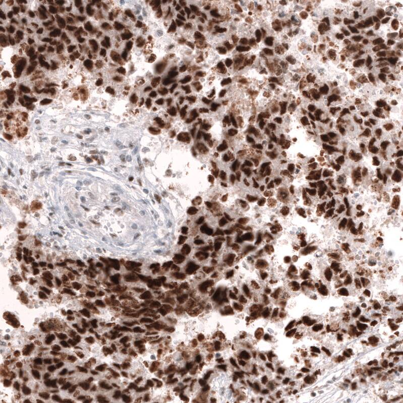 MSH2 Antibody (CL13724) - Azide and BSA Free Immunohistochemistry-Paraffin: MSH2 Antibody [NBP3-43852]