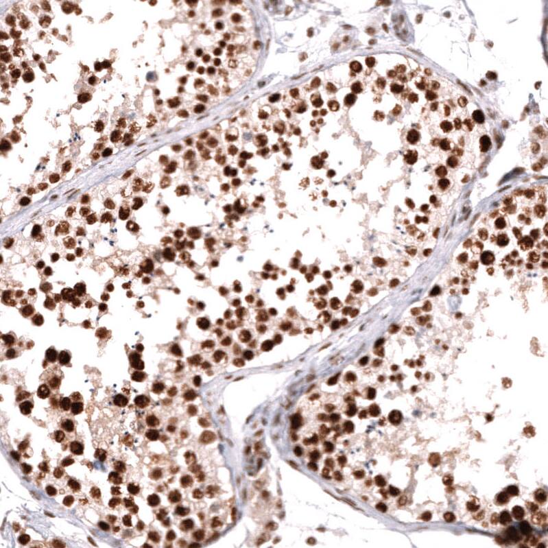 MSH2 Antibody (CL13724) - Azide and BSA Free Immunohistochemistry-Paraffin: MSH2 Antibody [NBP3-43852]
