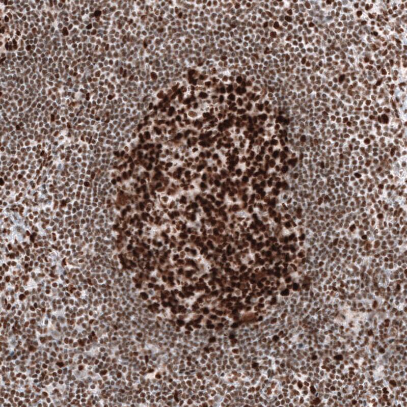 MSH2 Antibody (CL13724) - Azide and BSA Free Immunohistochemistry-Paraffin: MSH2 Antibody [NBP3-43852]