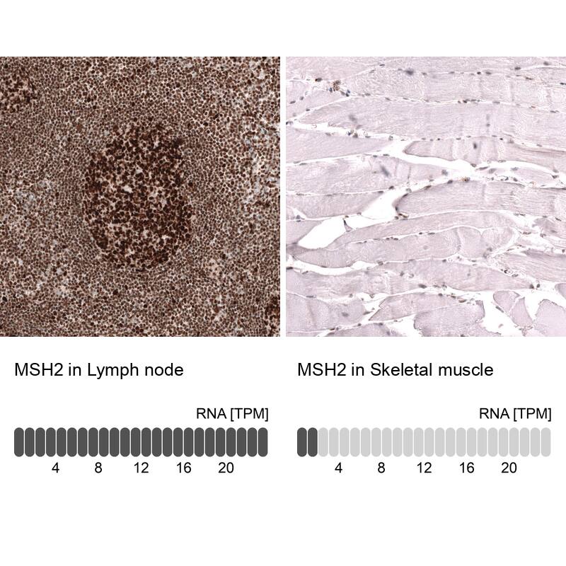 MSH2 Antibody (CL13764) - Azide and BSA Free Immunohistochemistry-Paraffin: MSH2 Antibody [NBP3-43853]