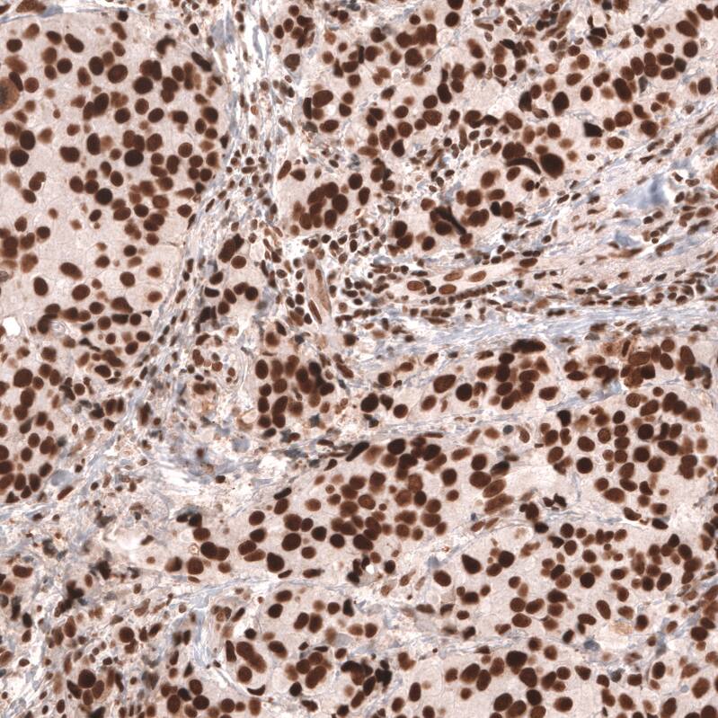 MSH2 Antibody (CL13764) - Azide and BSA Free Immunohistochemistry-Paraffin: MSH2 Antibody [NBP3-43853]