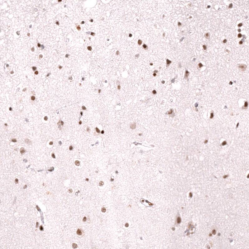 MSH2 Antibody (CL13764) - Azide and BSA Free Immunohistochemistry-Paraffin: MSH2 Antibody [NBP3-43853]