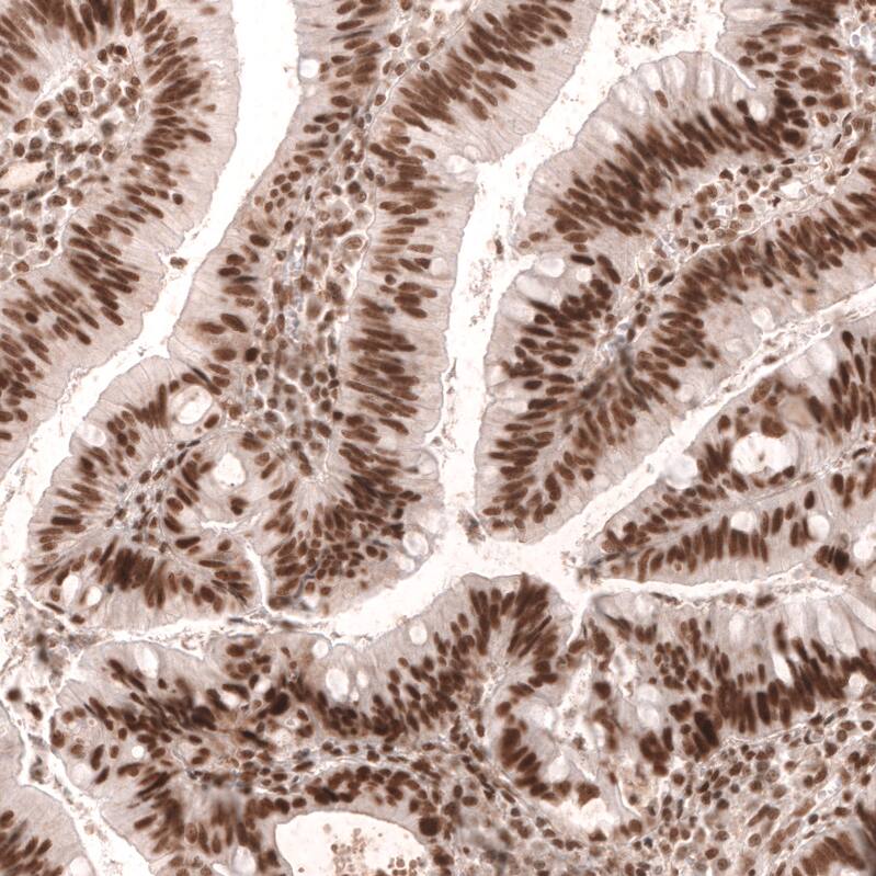 MSH2 Antibody (CL13764) - Azide and BSA Free Immunohistochemistry-Paraffin: MSH2 Antibody [NBP3-43853]