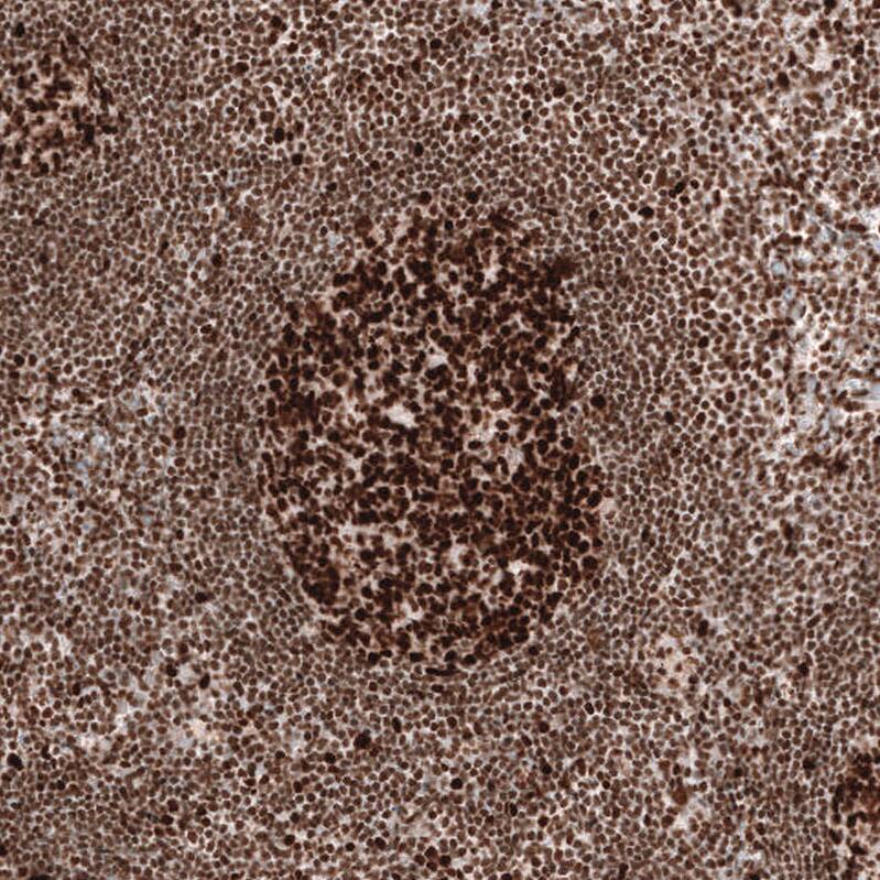 MSH2 Antibody (CL13764) - Azide and BSA Free Immunohistochemistry-Paraffin: MSH2 Antibody [NBP3-43853]