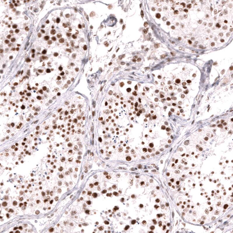 MSH2 Antibody (CL13764) - Azide and BSA Free Immunohistochemistry-Paraffin: MSH2 Antibody [NBP3-43853]