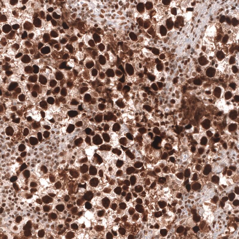MSH2 Antibody (CL13764) - Azide and BSA Free Immunohistochemistry-Paraffin: MSH2 Antibody [NBP3-43853]