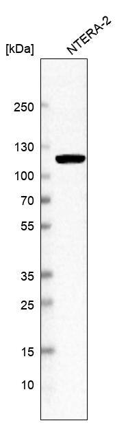 MSH2 Antibody (CL13764) - Azide and BSA Free Western Blot: MSH2 Antibody [NBP3-43853]