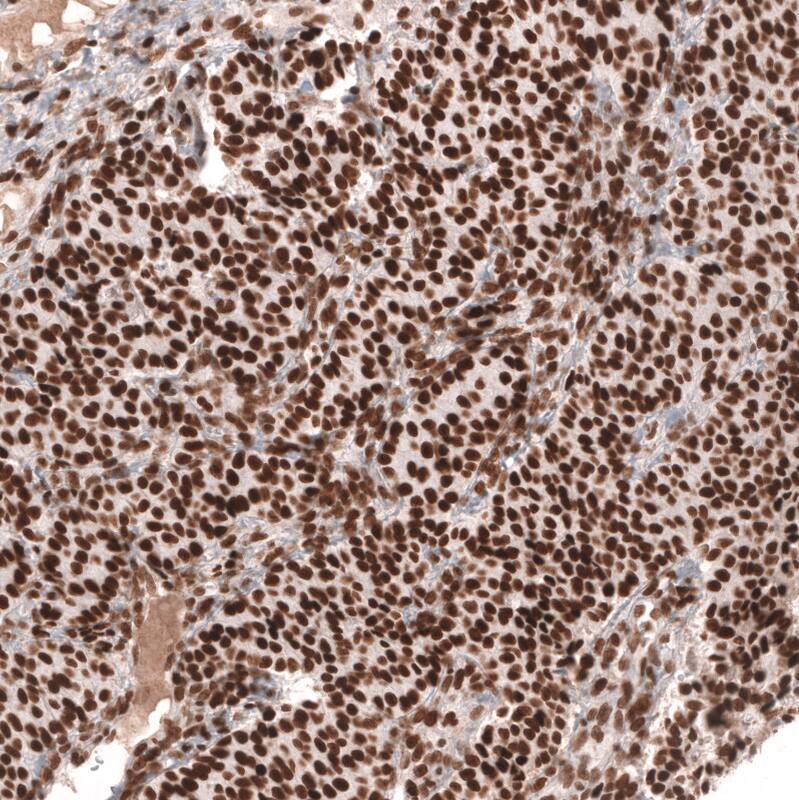 MSH2 Antibody (CL13764) - Azide and BSA Free Immunohistochemistry-Paraffin: MSH2 Antibody [NBP3-43853]