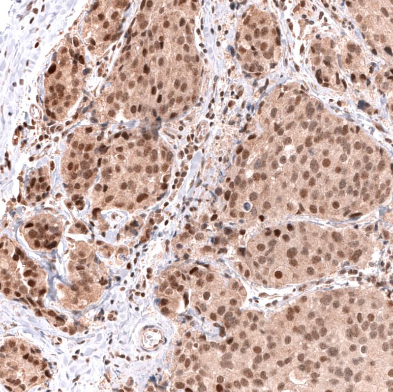 MSH3 Antibody (CL14059) - Azide and BSA Free Immunohistochemistry-Paraffin: MSH3 Antibody [NBP3-43855]