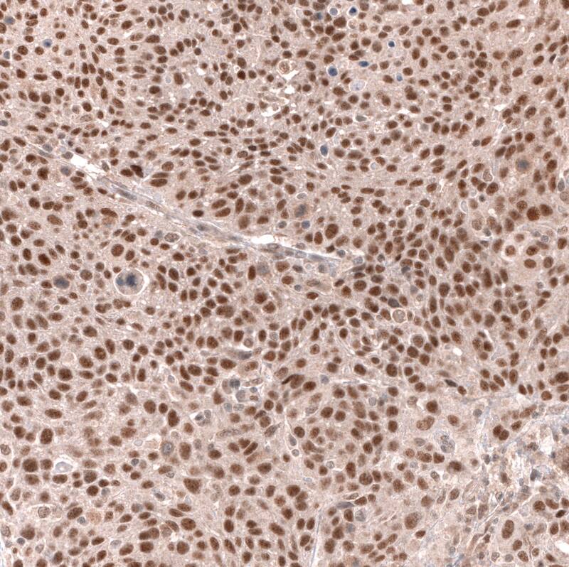 MSH3 Antibody (CL14059) - Azide and BSA Free Immunohistochemistry-Paraffin: MSH3 Antibody [NBP3-43855]